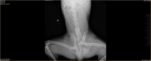 Pelvic Fracture, Radiograph