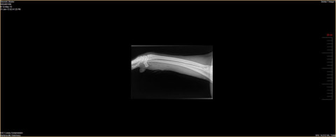Trauma to muscle but not bone, Radiograph